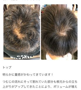 Next