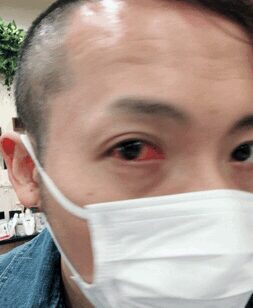 Next