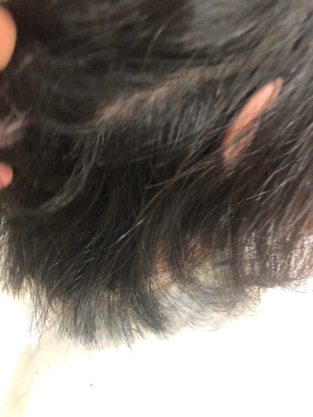 【大阪】ダメージとクセで広がる髪の毛にはジュエリーシステムトリートメントと縮毛矯正がオススメ