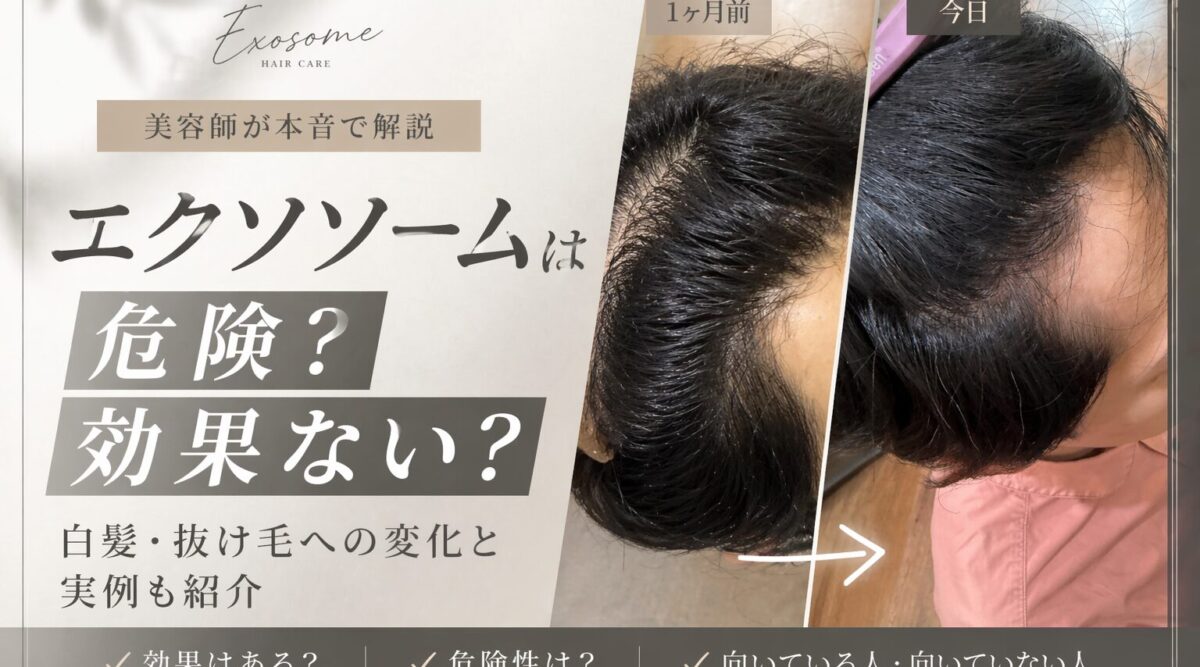 エクソソームは危険？効果はないの？実例からの説明