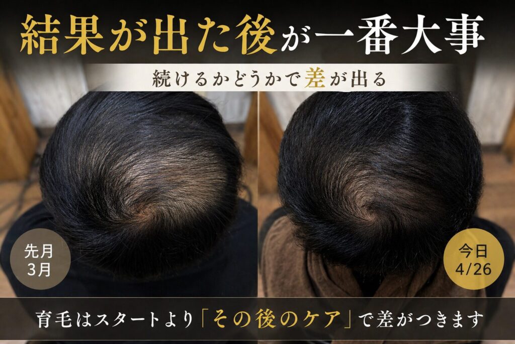 ホームケアでの1ヶ月の育毛の変化