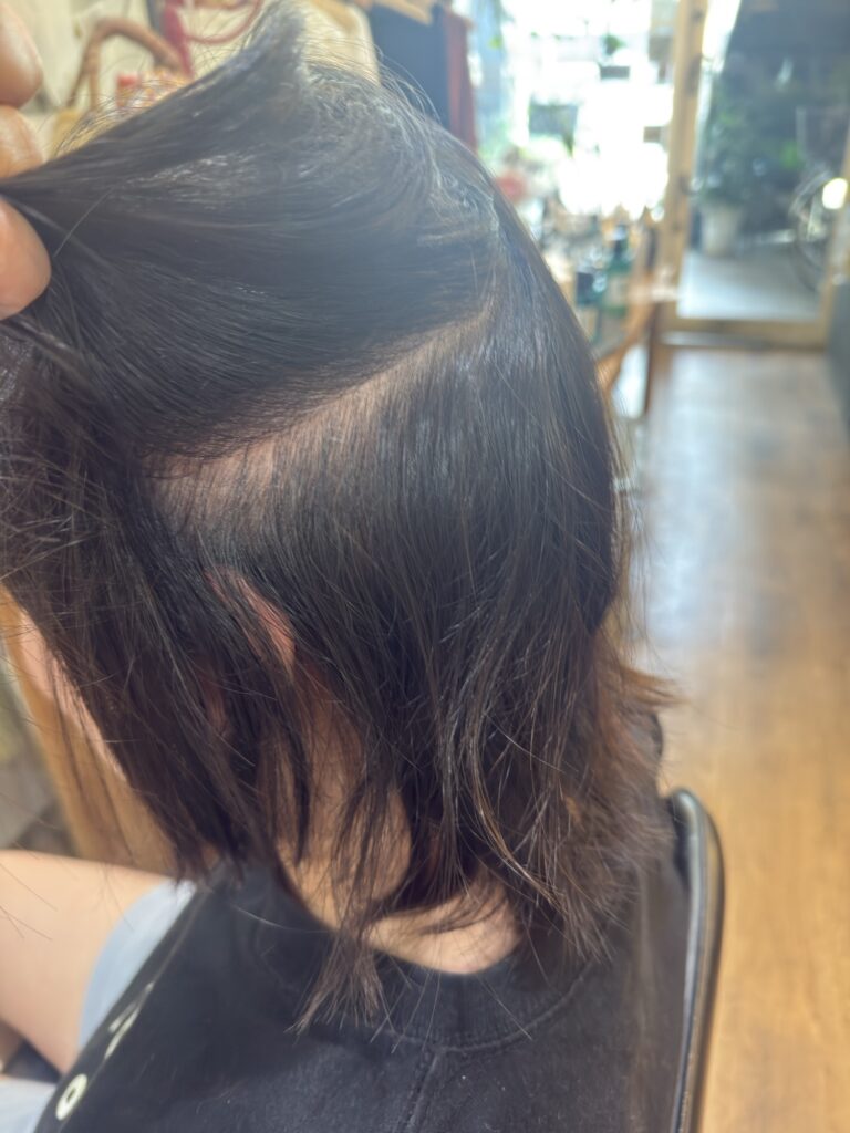 耳の後ろのショートのくせ毛