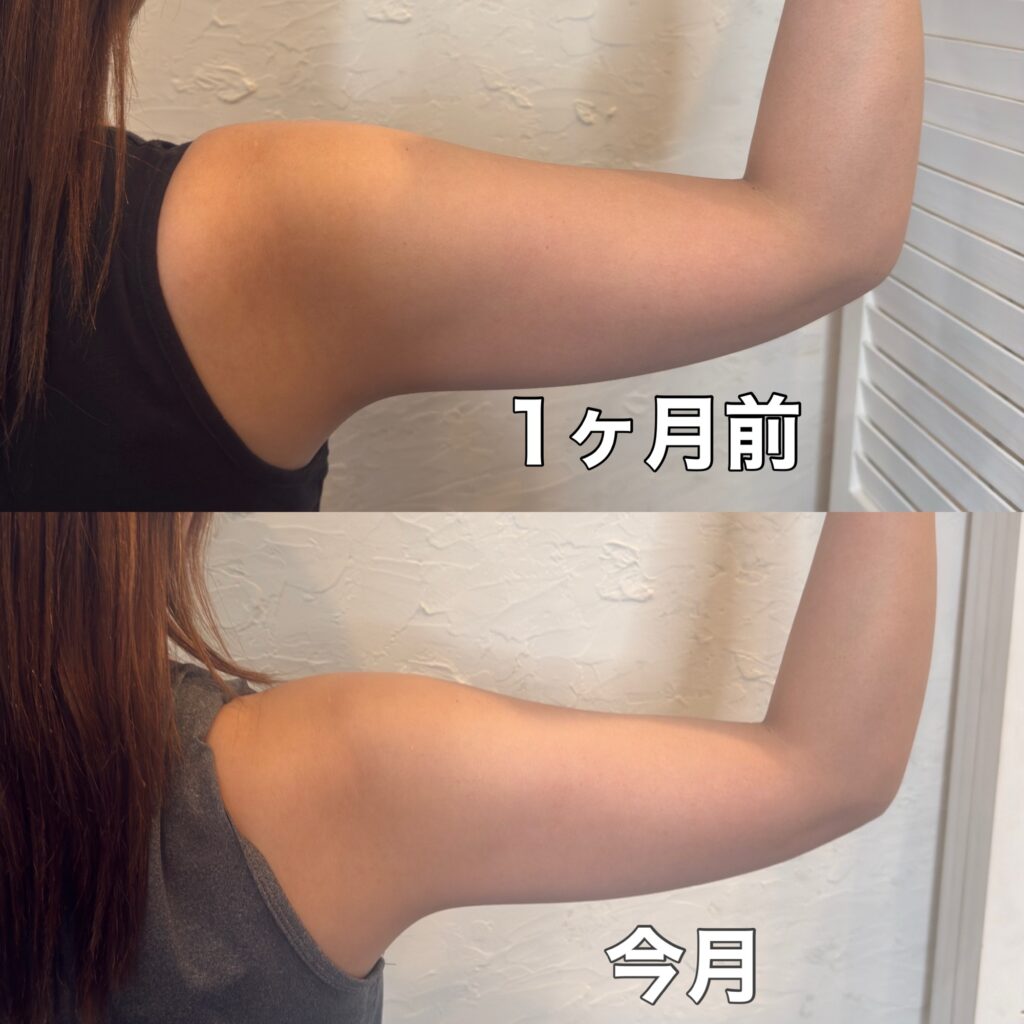 後ろから見たデポロエステの1ヶ月での変化