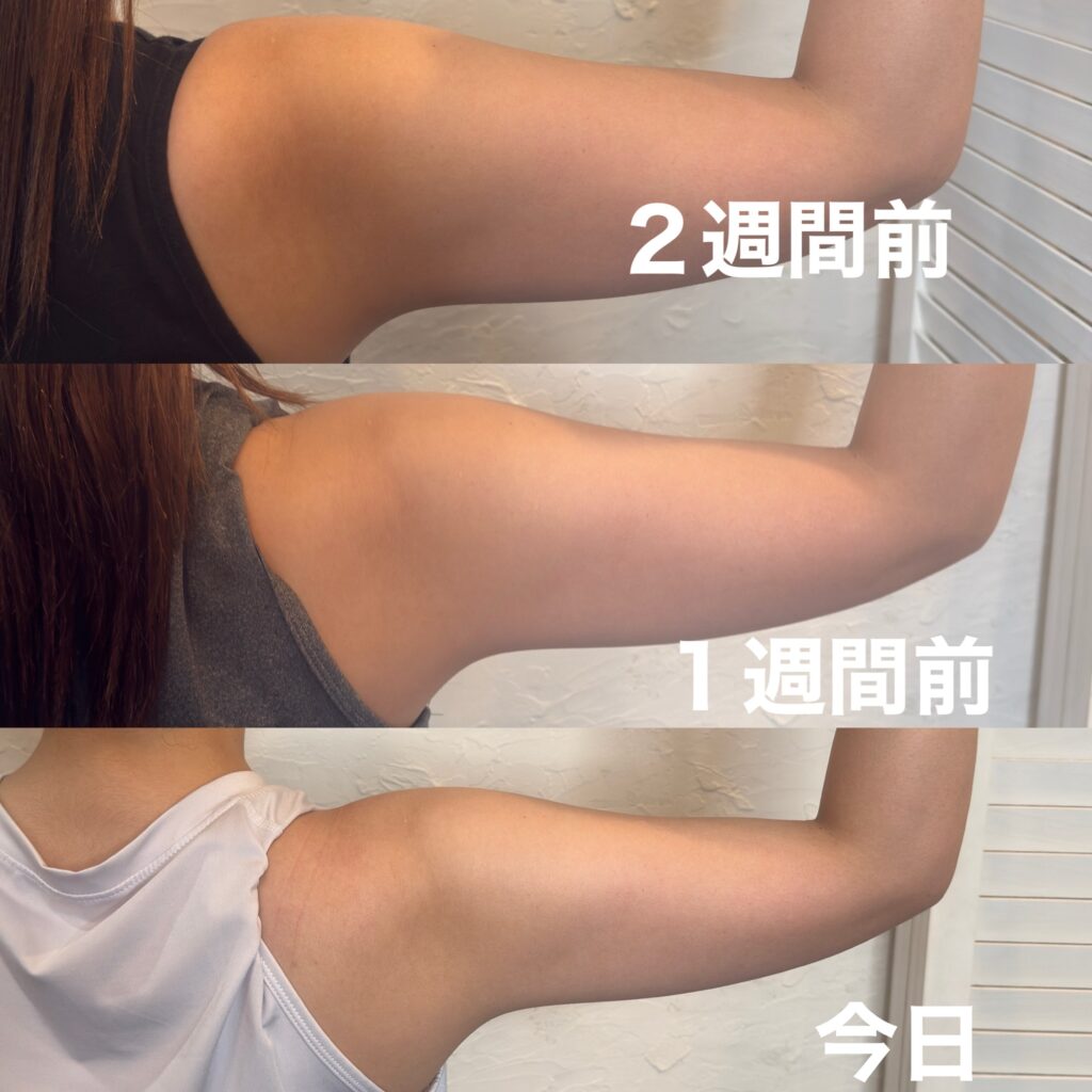 画像 デポロエステの成果