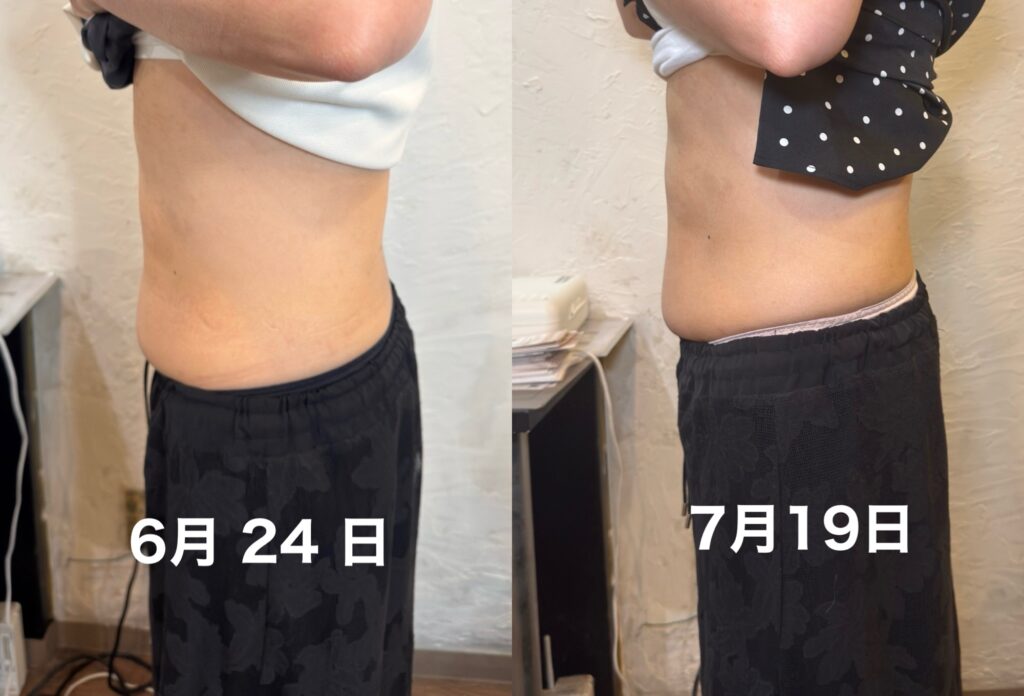 デポロエステ横からの変化