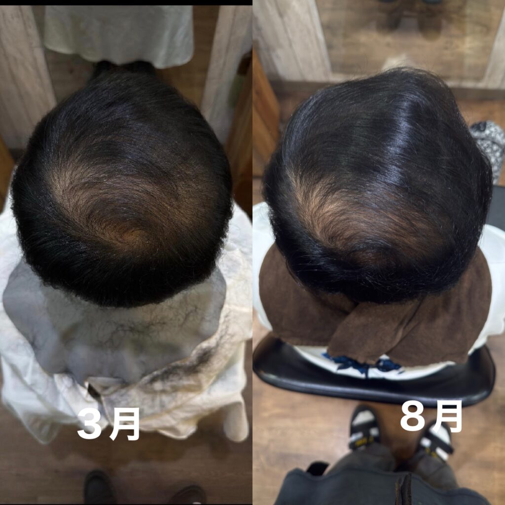 育毛結果